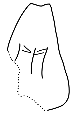Tracing of HT Wa 1592