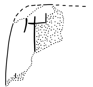 Tracing of KH 45