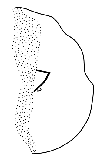 Tracing of KH Wc 2084