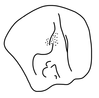 Tracing of KH Wc 2113